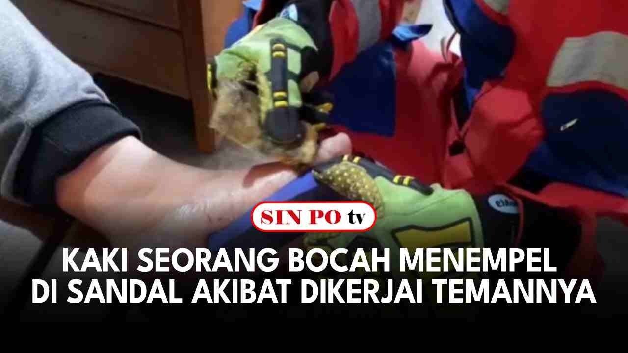 Kaki Seorang Bocah Menempel di Sandal Akibat Dikerjai Temannya