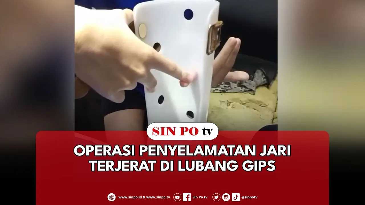 Operasi Penyelamatan Jari Terjerat Di Lubang Gips