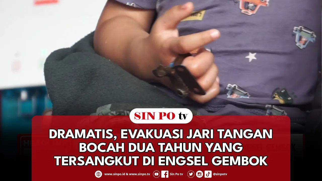 Dramatis, Evakuasi Jari Tangan Bocah Dua Tahun Yang Tersangkut Di Engsel Gembok