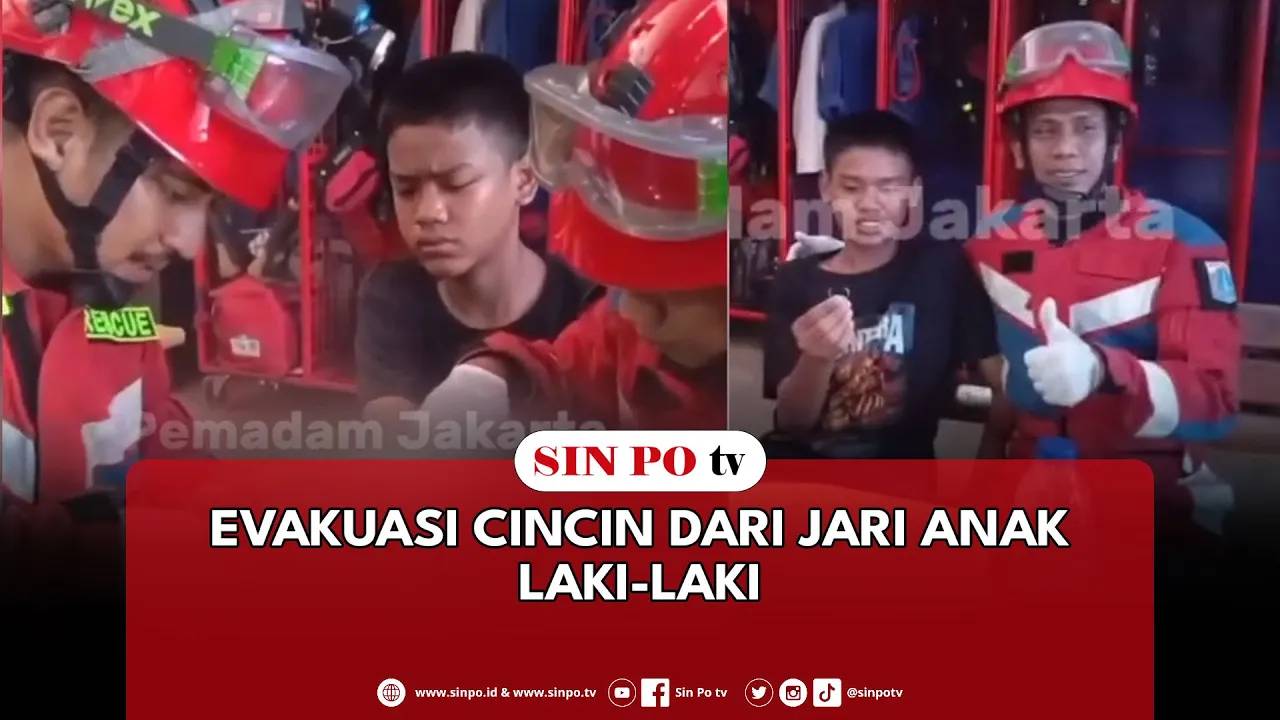 Evakuasi Cincin Dari Jari Anak Laki-Laki