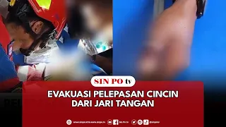 Evakuasi Pelepasan Cincin Dari Jari Tangan