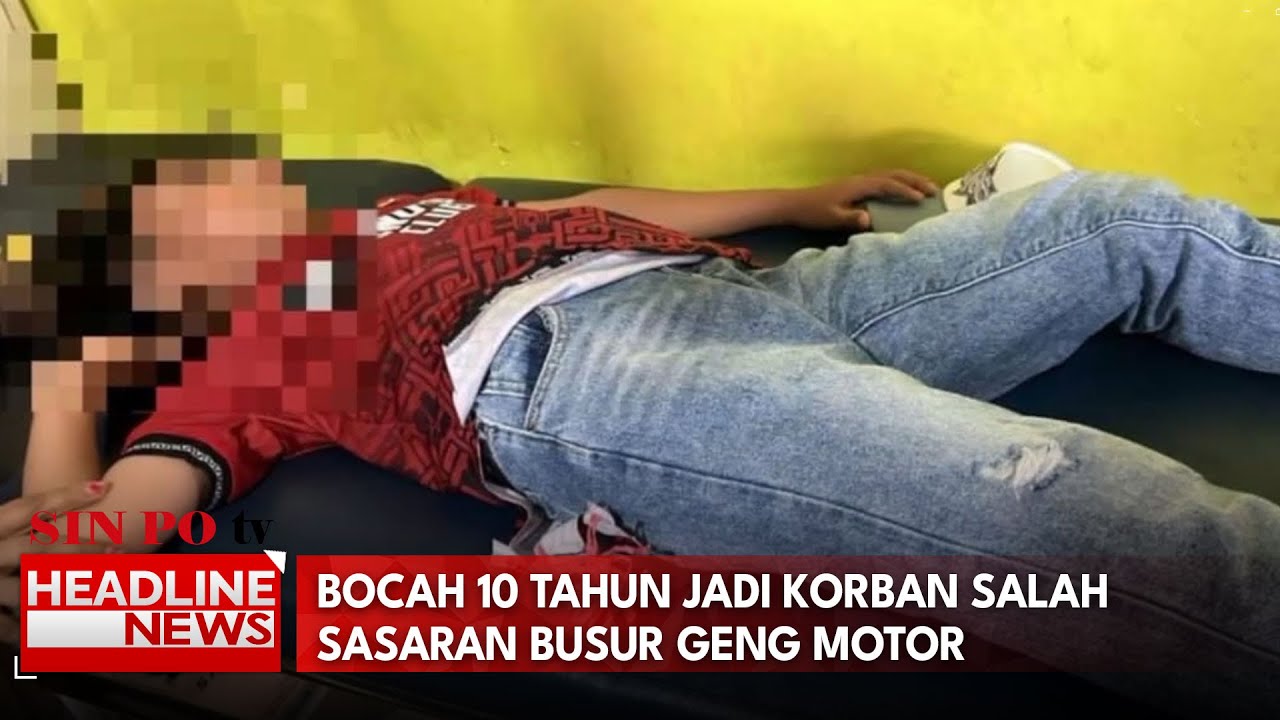 Bocah 10 Tahun Jadi Korban Salah Sasaran Busur Geng Motor