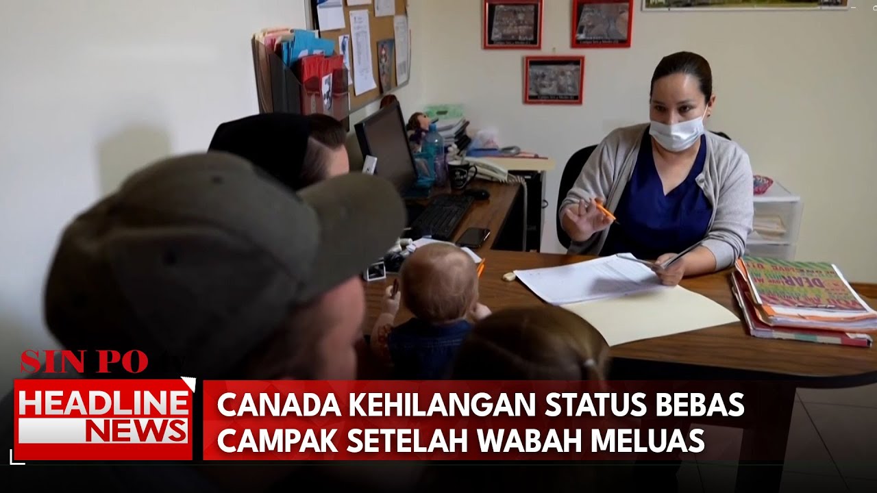 Canada Kehilangan Status Bebas Campak Setelah Wabah Meluas
