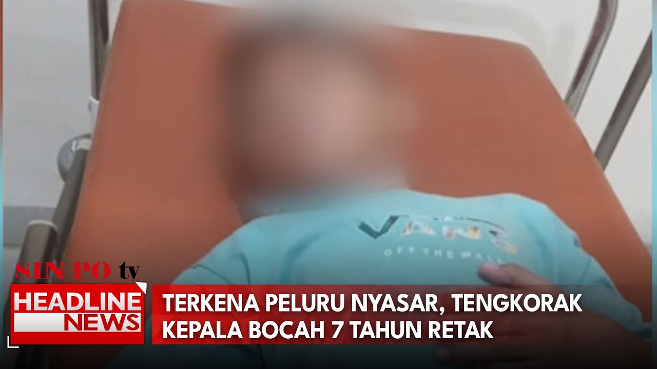 Terkena Peluru Nyasar, Tengkorak Kepala Bocah 7 Tahun Retak