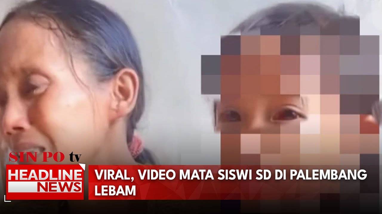 Viral, Video Mata Siswi SD di Palembang Lebam