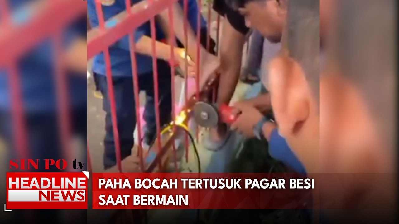 Paha Bocah Tertusuk Pagar Besi Saat Bermain
